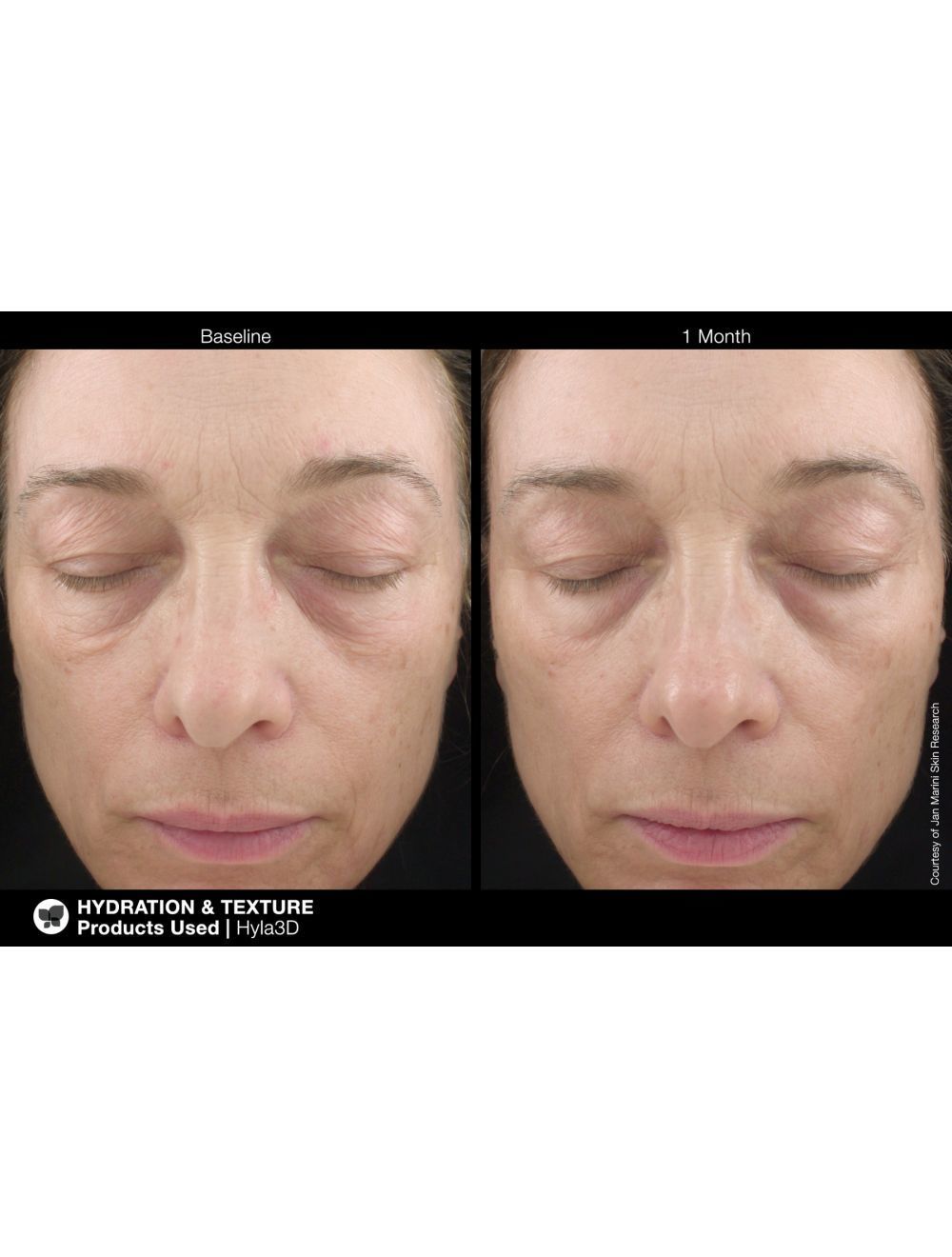 ジャンマリーニ　ハイラフェイスセラム　HYLA 3D FACE SERUM ジャンマリーニ ハイラ フェイスクリーム ハイラ フェイスセラム(販売