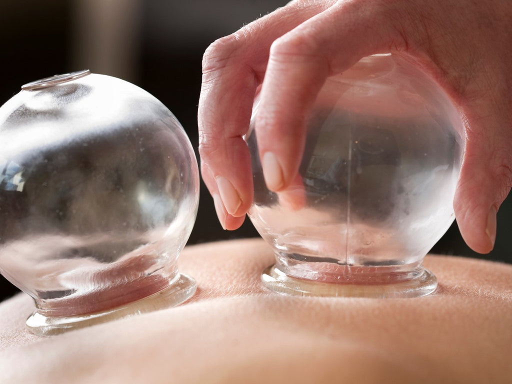 6 Incredible Benefits of Cupping Therapy - Mysa Day Spa