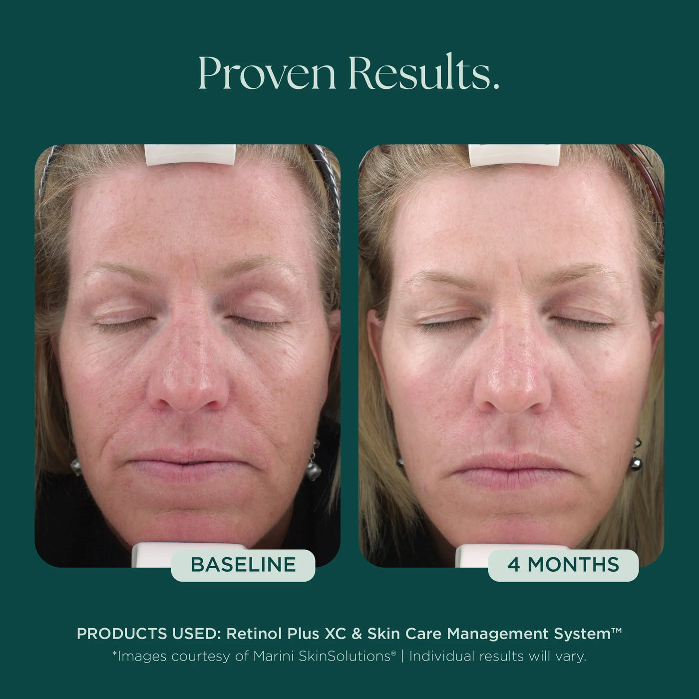 Jan Marini Retinol Plus - Premium Jan Marini Skin Research from Mysa Day Spa - Just $110! Shop now at Mysa Day Spa