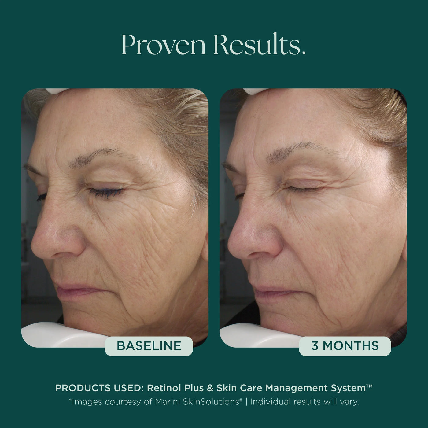 Jan Marini Retinol Plus - Premium Jan Marini Skin Research from Mysa Day Spa - Just $110! Shop now at Mysa Day Spa