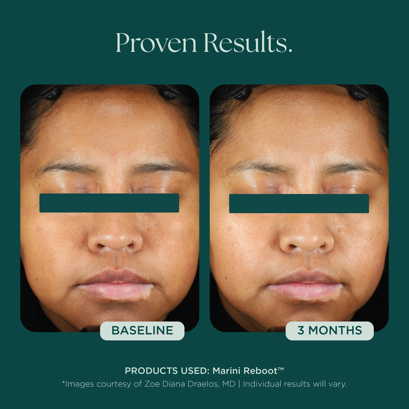 Marini Reboot PDRN Serum - Premium Jan Marini Skin Research from Mysa Day Spa - Just $160! Shop now at Mysa Day Spa