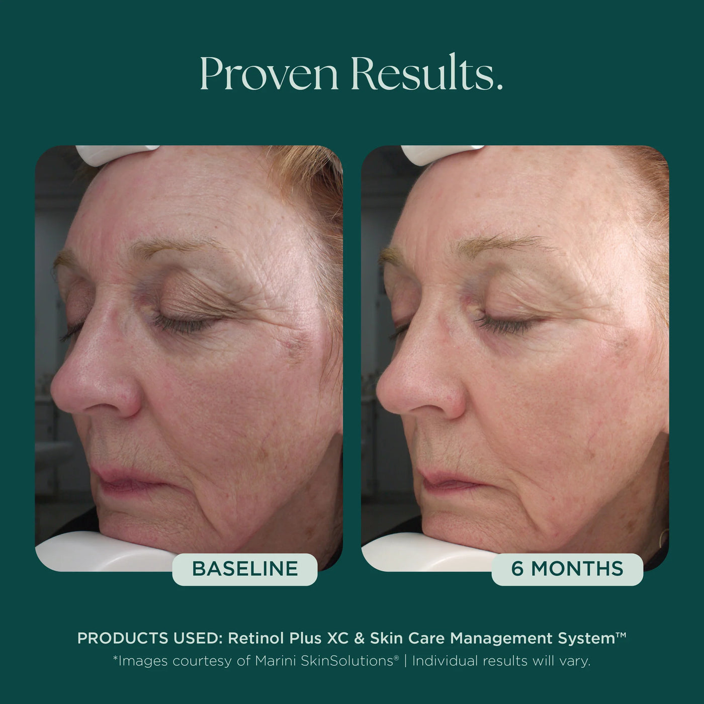 Jan Marini Retinol Plus - Premium Jan Marini Skin Research from Mysa Day Spa - Just $110! Shop now at Mysa Day Spa