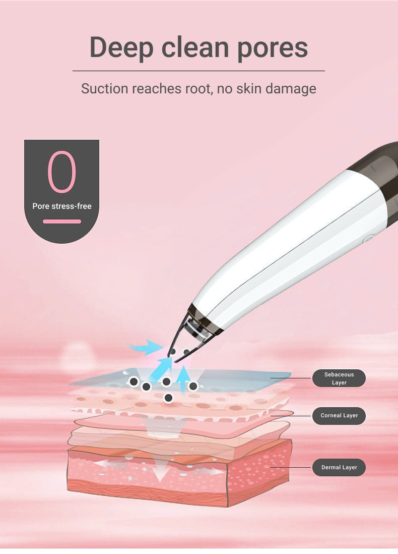 Mysa Day Spa - Blackhead Vacuum Device - Mysa Day Spa