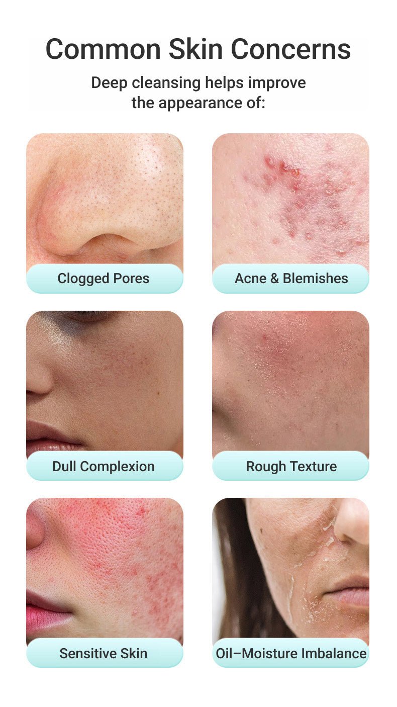 Mysa Day Spa - Hot and Cold Silicone Facial Cleanser - Mysa Day Spa