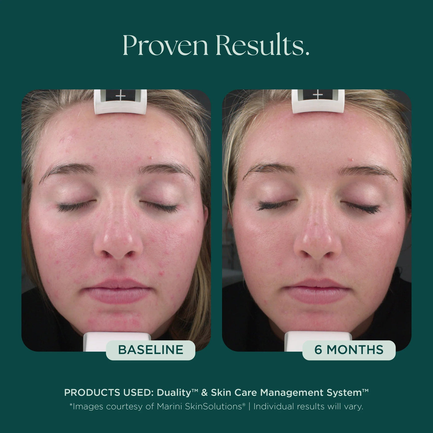 Marini Duality™ - Premium Jan Marini Skin Research from Mysa Day Spa - Just $120! Shop now at Mysa Day Spa