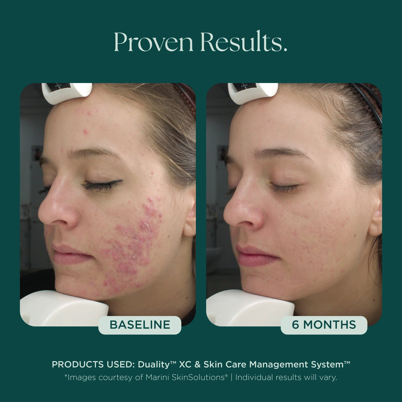 Marini Duality™ - Premium Jan Marini Skin Research from Mysa Day Spa - Just $120! Shop now at Mysa Day Spa