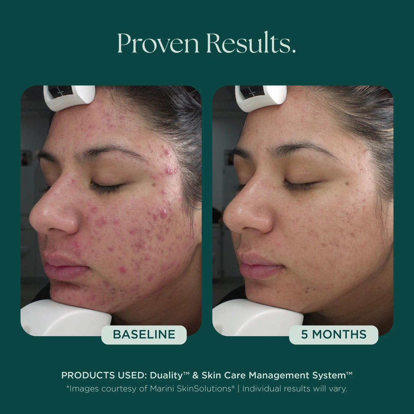 Marini Duality™ - Premium Jan Marini Skin Research from Mysa Day Spa - Just $120! Shop now at Mysa Day Spa
