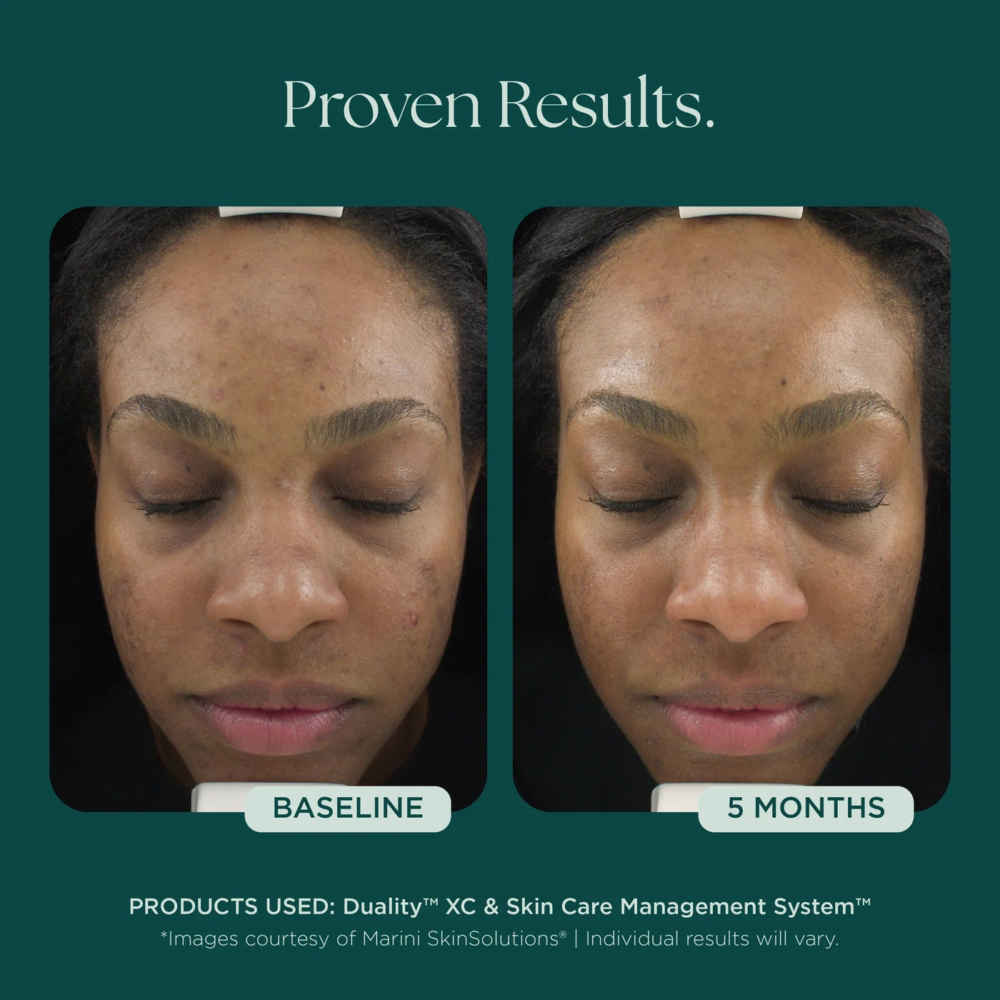 Marini Duality™ - Premium Jan Marini Skin Research from Mysa Day Spa - Just $120! Shop now at Mysa Day Spa