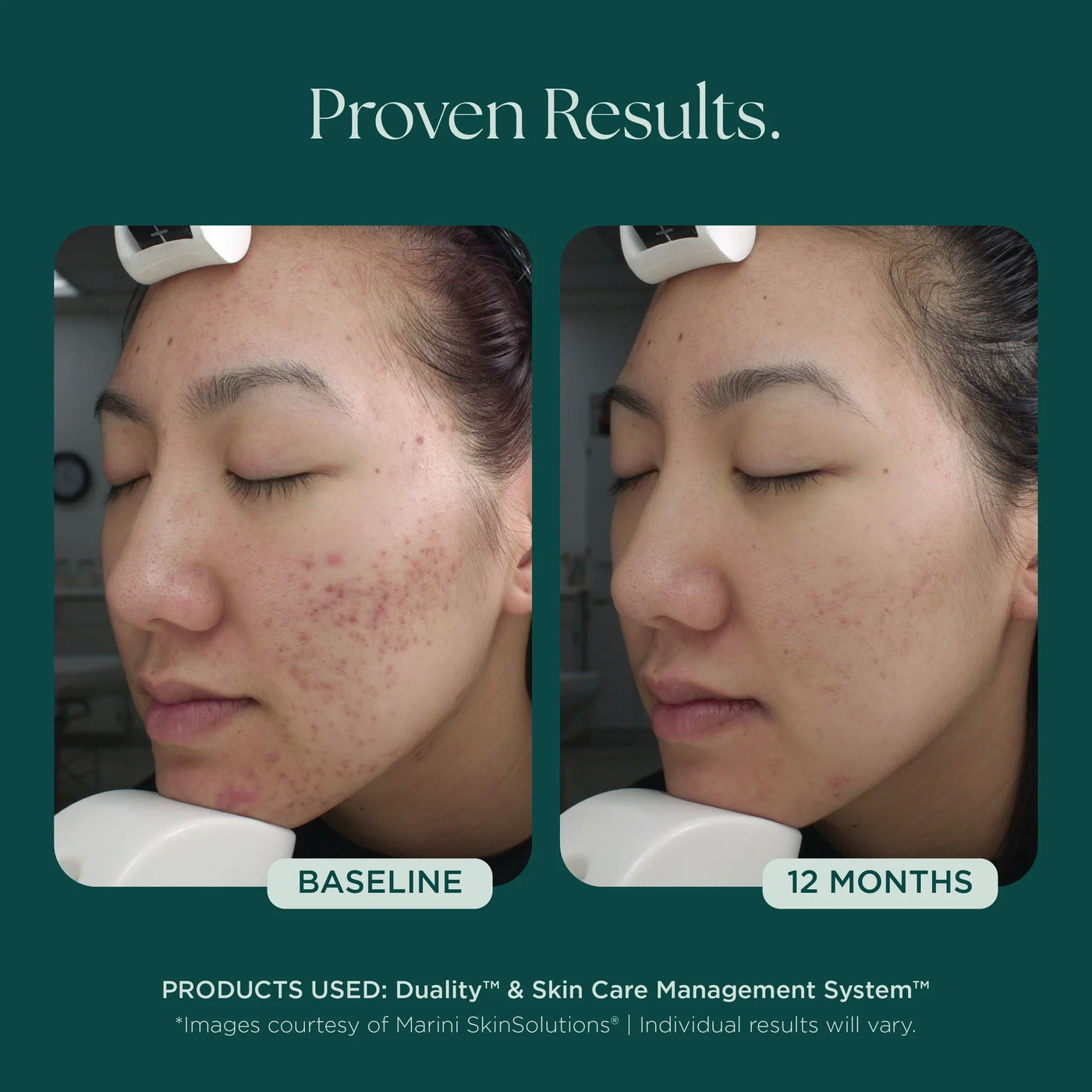 Marini Duality™ - Premium Jan Marini Skin Research from Mysa Day Spa - Just $120! Shop now at Mysa Day Spa