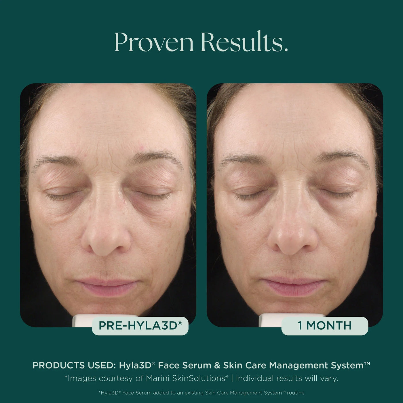 Marini Hyla3D® Face Serum Hyaluronic Acid Complex - Premium Jan Marini Skin Research from Mysa Day Spa - Just $125! Shop now at Mysa Day Spa