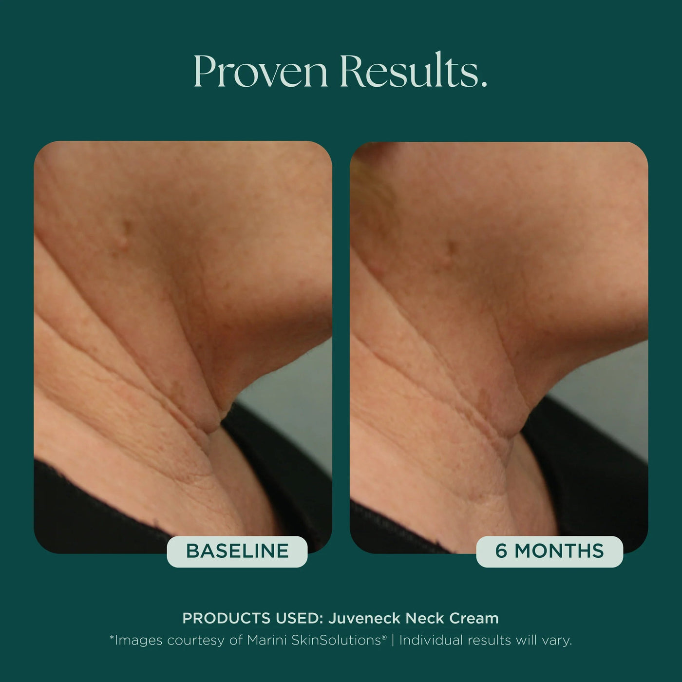 Marini Juveneck Neck Cream - Premium Jan Marini Skin Research from Mysa Day Spa - Just $98! Shop now at Mysa Day Spa