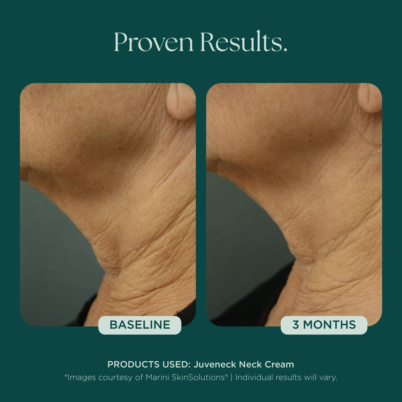 Marini Juveneck Neck Cream - Premium Jan Marini Skin Research from Mysa Day Spa - Just $98! Shop now at Mysa Day Spa