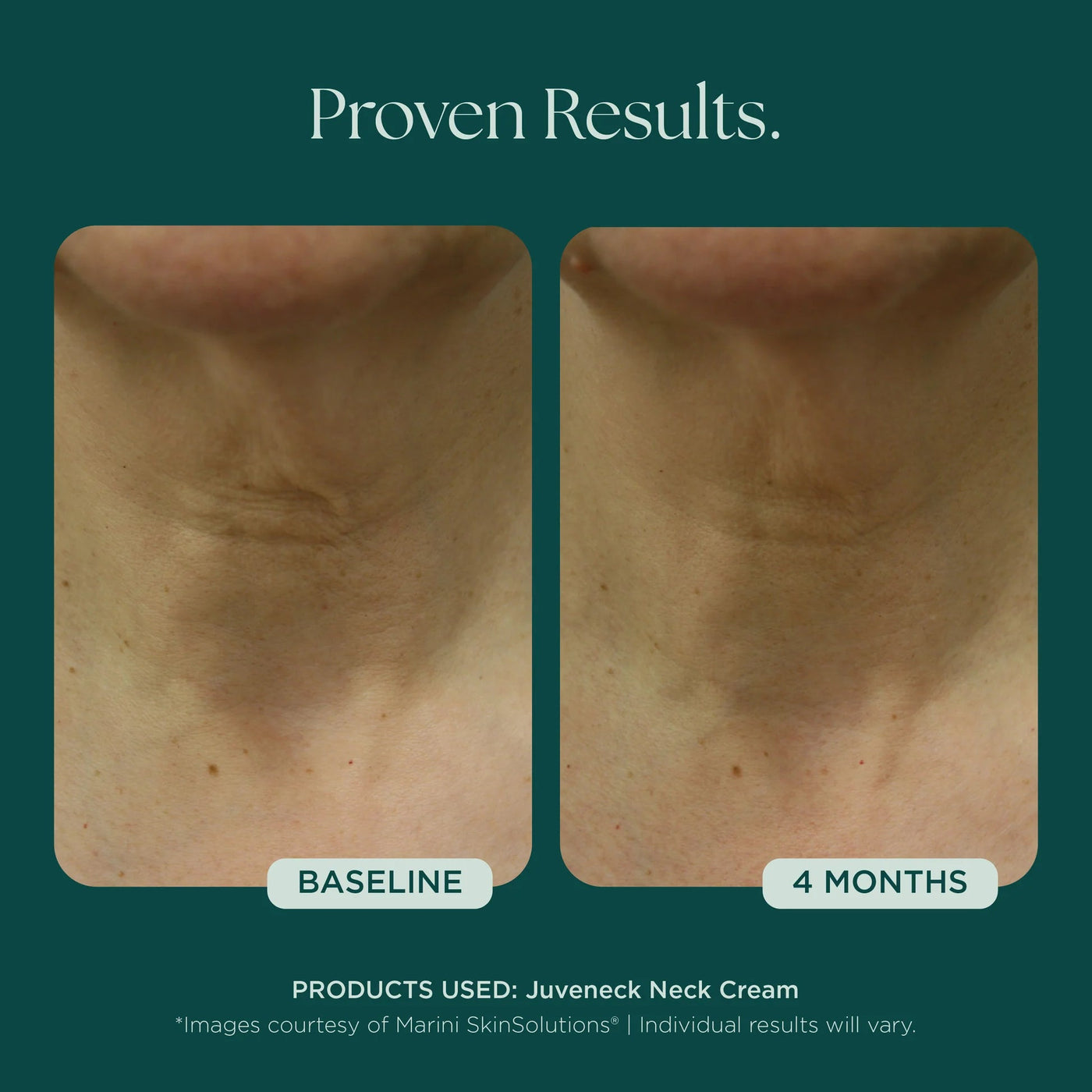 Marini Juveneck Neck Cream - Premium Jan Marini Skin Research from Mysa Day Spa - Just $98! Shop now at Mysa Day Spa