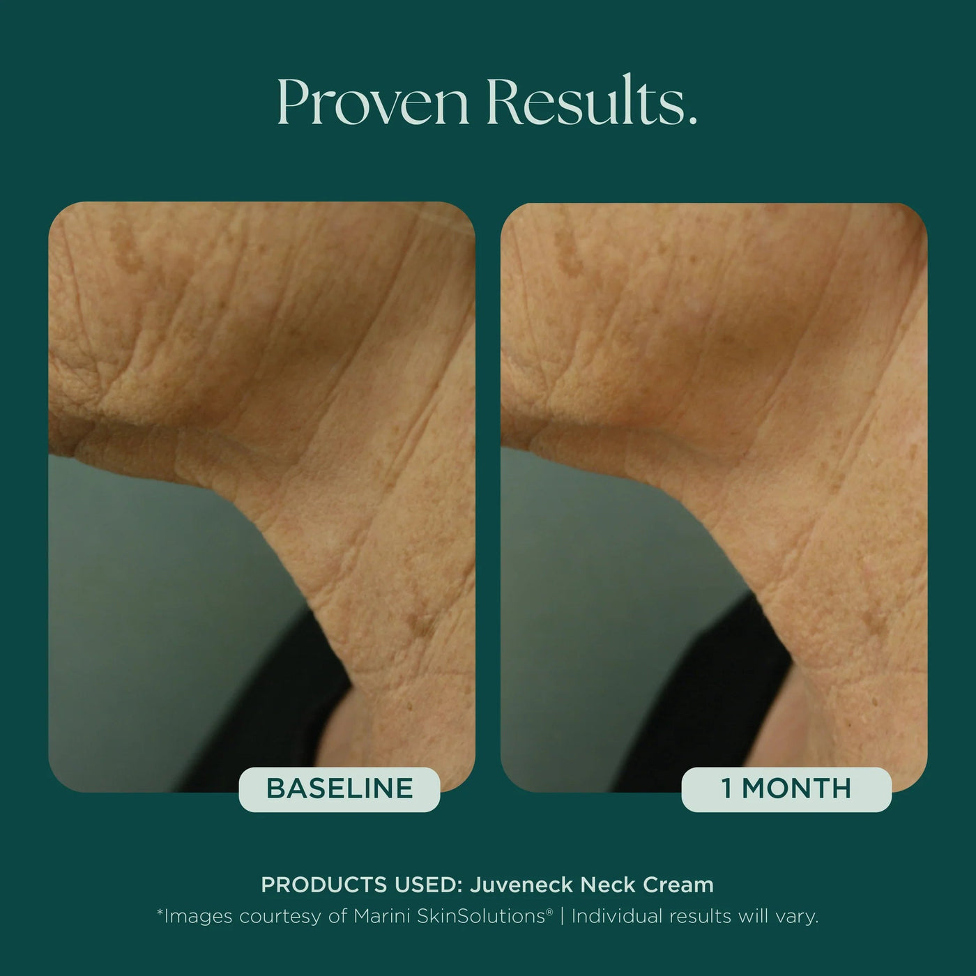 Marini Juveneck Neck Cream - Premium Jan Marini Skin Research from Mysa Day Spa - Just $98! Shop now at Mysa Day Spa