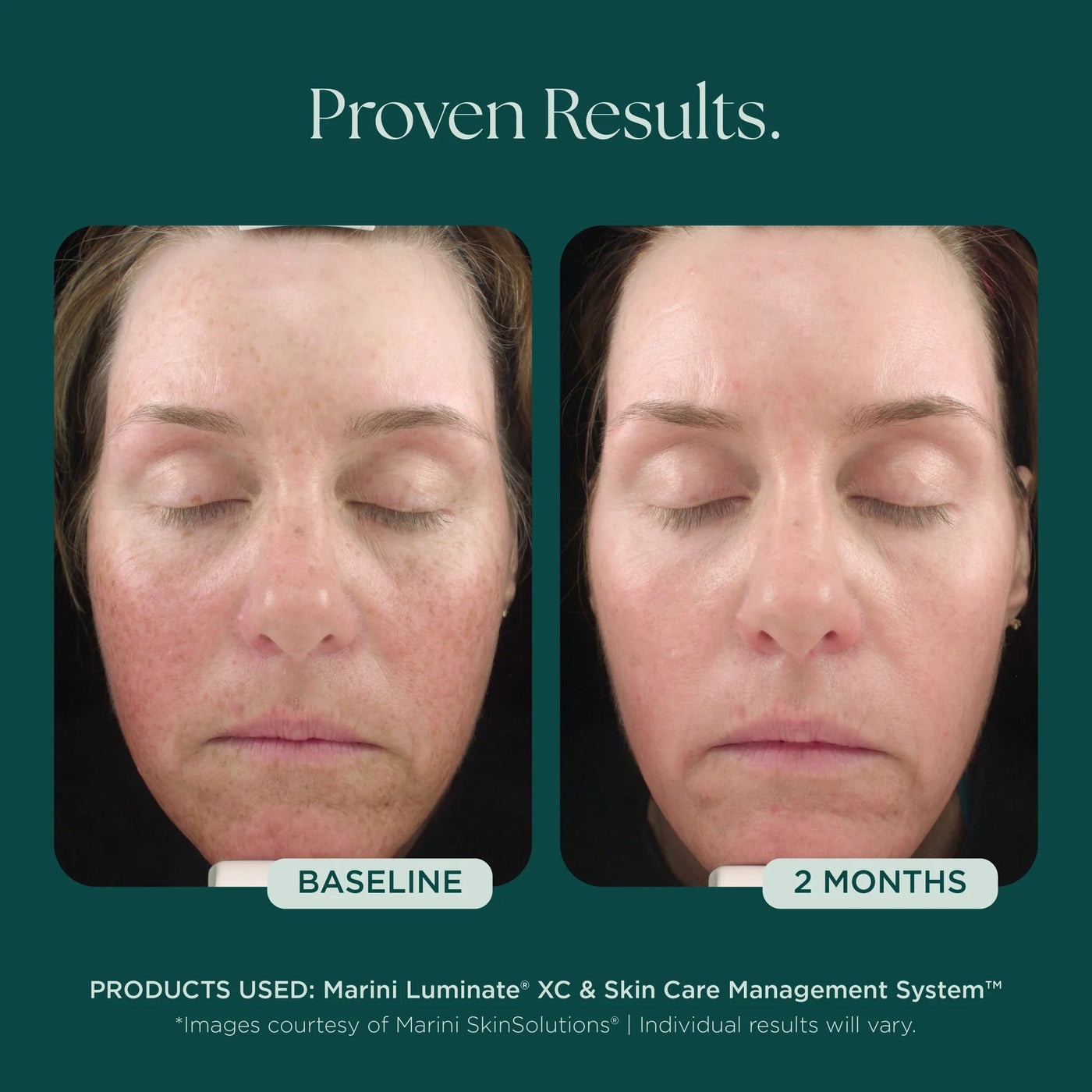 Mysa Day Spa - Jan Marini Luminate® - Mysa Day Spa