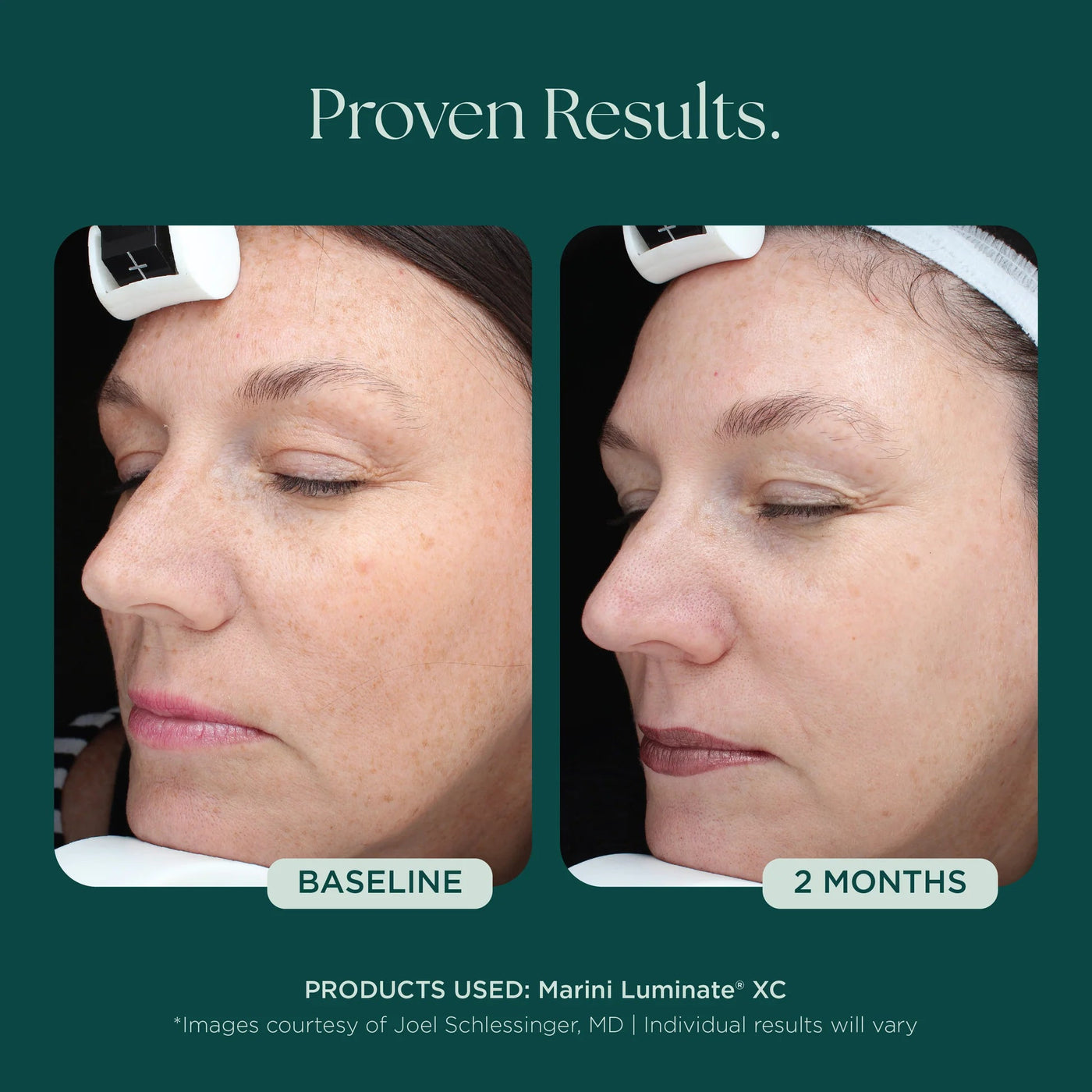 Mysa Day Spa - Jan Marini Luminate® - Mysa Day Spa