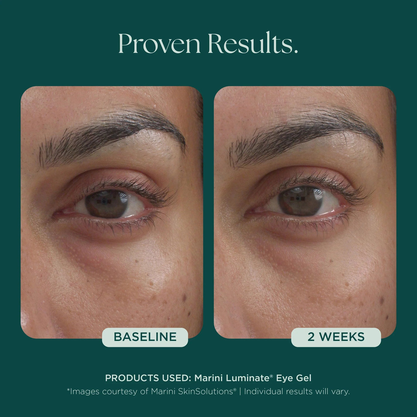 Marini Luminate® Eye Gel - Premium Jan Marini Skin Research from Mysa Day Spa - Just $108! Shop now at Mysa Day Spa