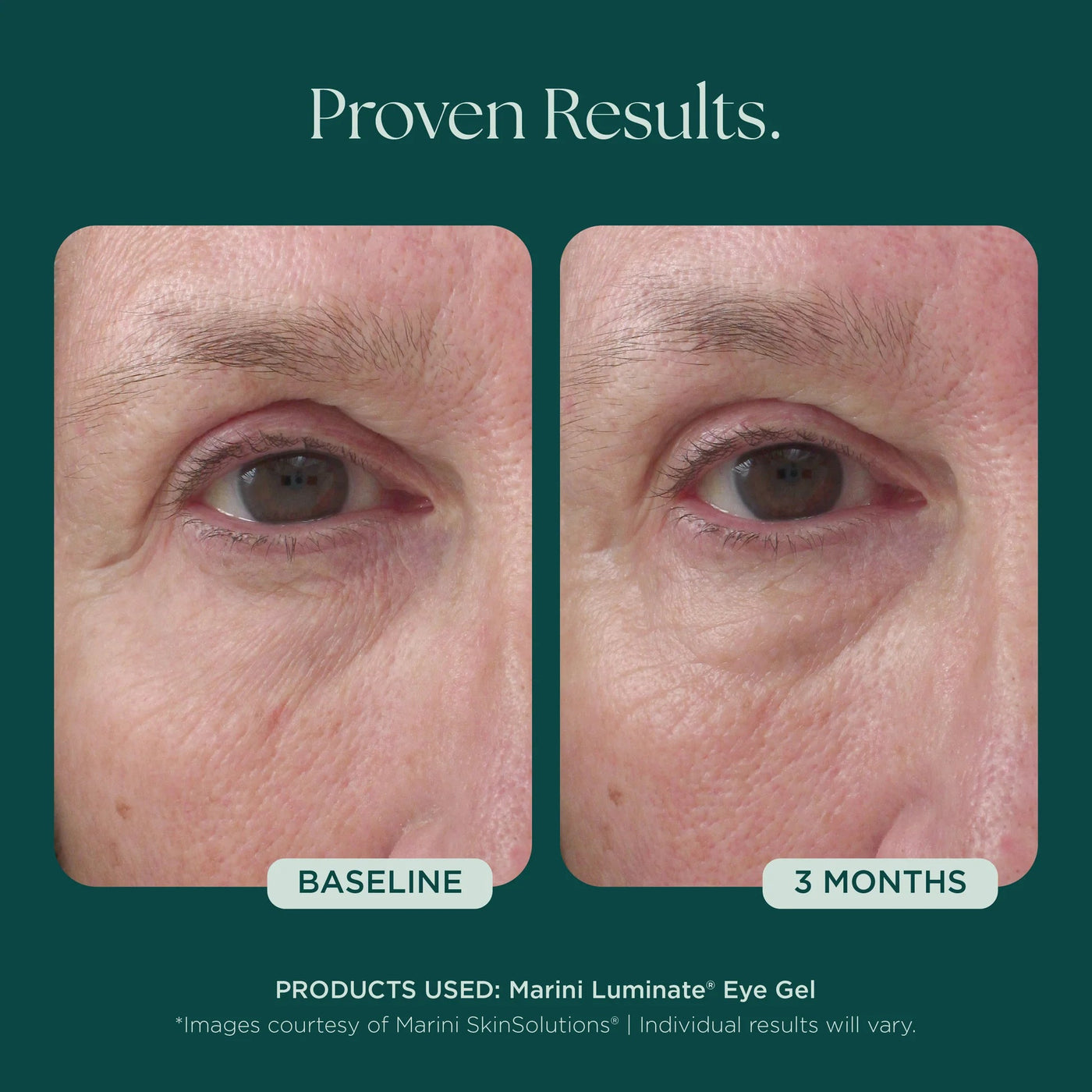 Marini Luminate® Eye Gel - Premium Jan Marini Skin Research from Mysa Day Spa - Just $108! Shop now at Mysa Day Spa