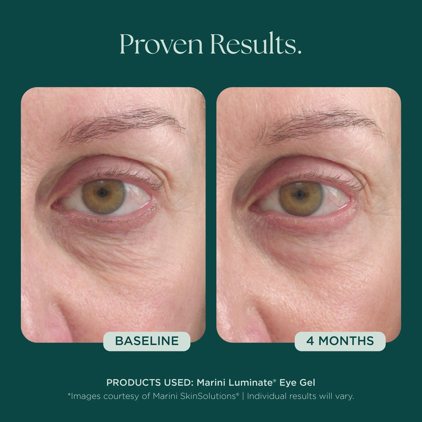 Marini Luminate® Eye Gel - Premium Jan Marini Skin Research from Mysa Day Spa - Just $108! Shop now at Mysa Day Spa