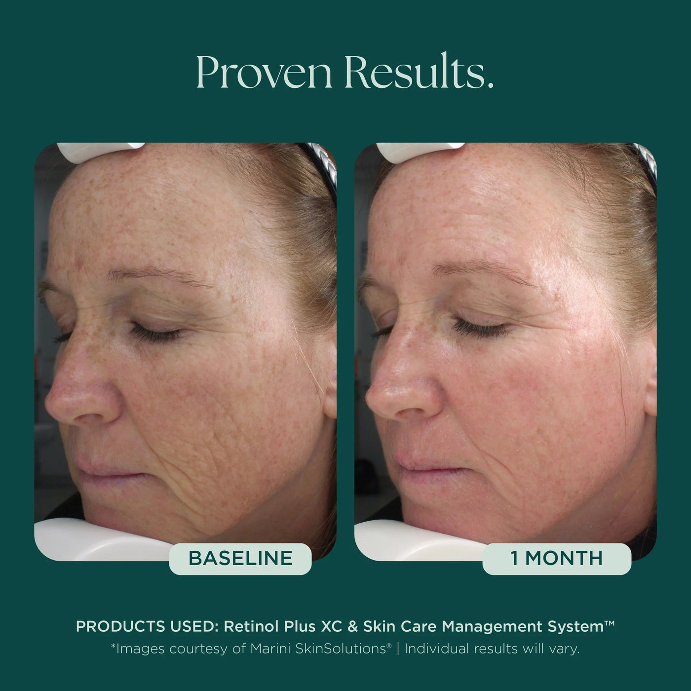 Mysa Day Spa - Jan Marini Retinol Plus - Mysa Day Spa