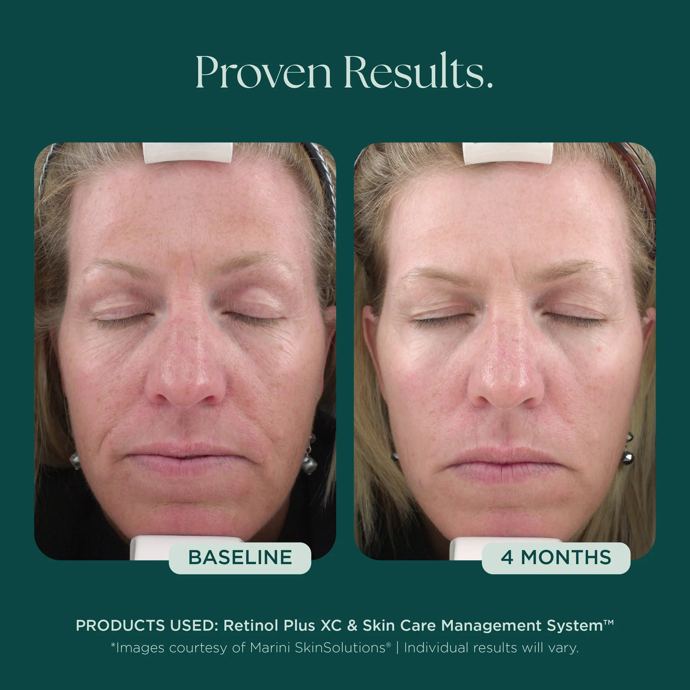 Mysa Day Spa - Jan Marini Retinol Plus - Mysa Day Spa