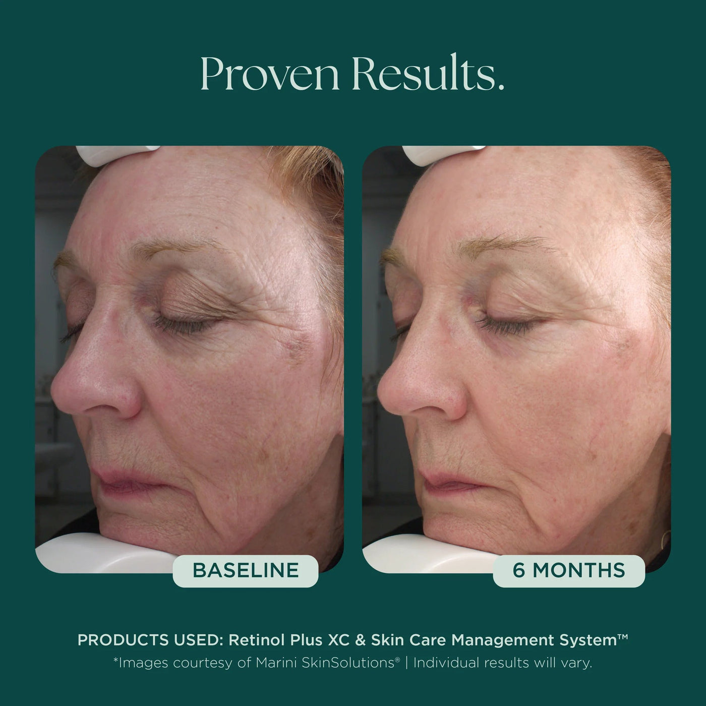 Mysa Day Spa - Jan Marini Retinol Plus - Mysa Day Spa