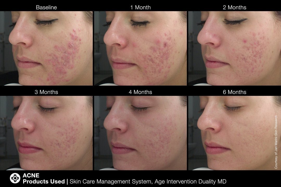 Jan Marini Age Intervention® Duality™ | Best Price at Mysa