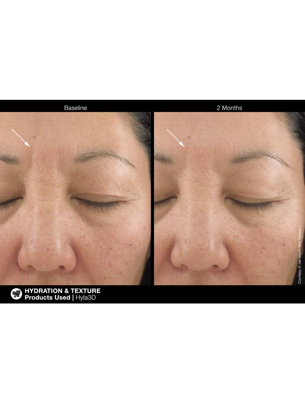 Jan Marini Hyla 3D Face Serum | Best Price at Mysa Day Spa